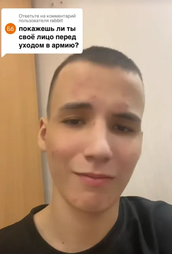 Тиктокер Травка показывает лицо в ответ на вопрос подписчика перед уходом в армию